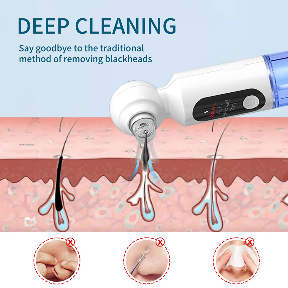 Blackhead Remover Pore Vacuum  - đánh giá và giá Pore Vacuum