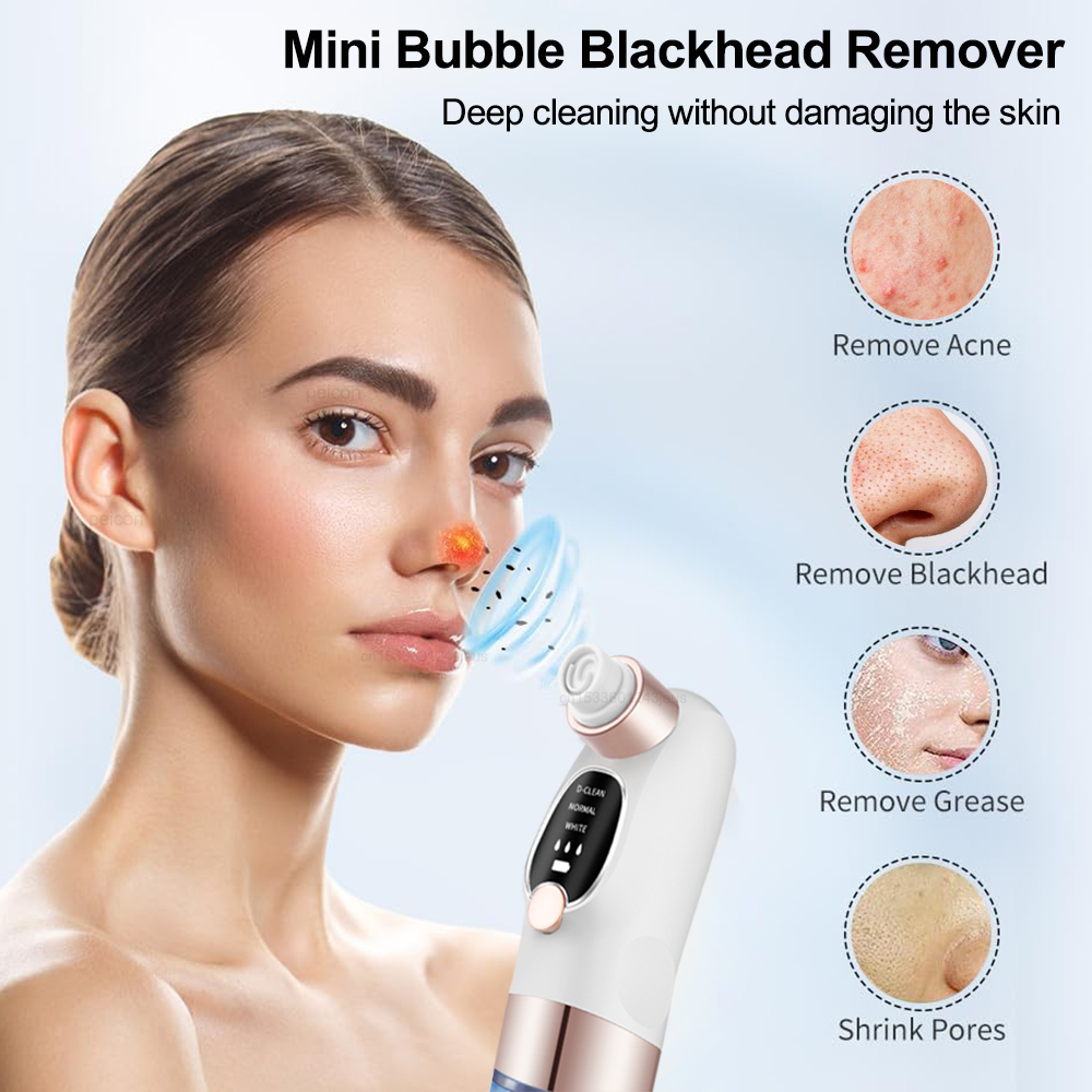 Electric Blackhead Remover Vac - đánh giá và giá Pore Vacuum