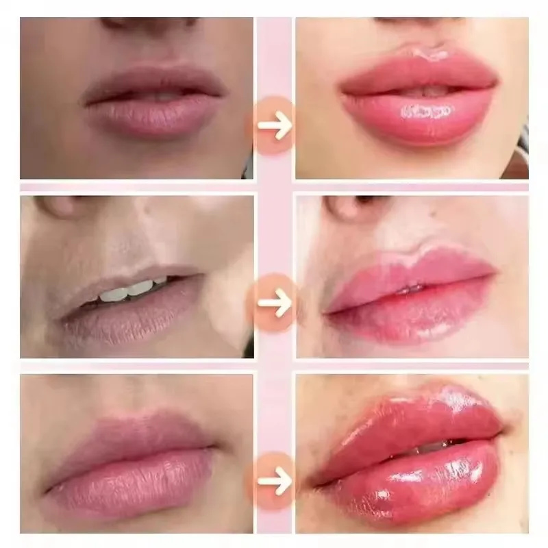Instant Lip Plumping Essential - đánh giá và giá Lip Gloss Plumping