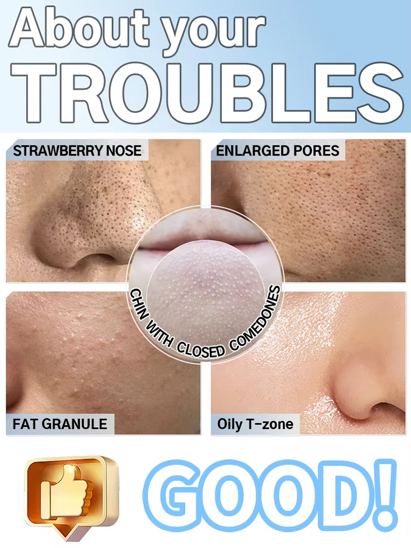 Blackhead Remover Pore Cleaner - đánh giá và giá Pore Vacuum