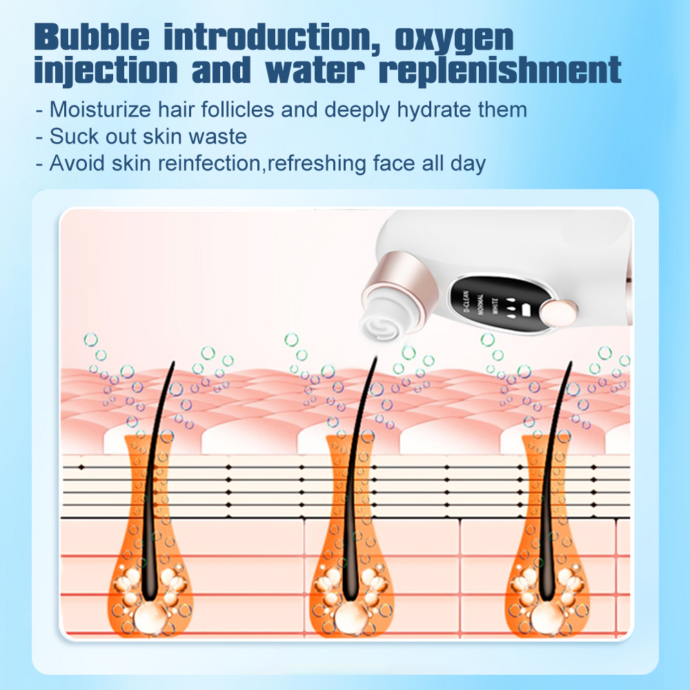 Electric Blackhead Remover Por - đánh giá và giá Pore Vacuum