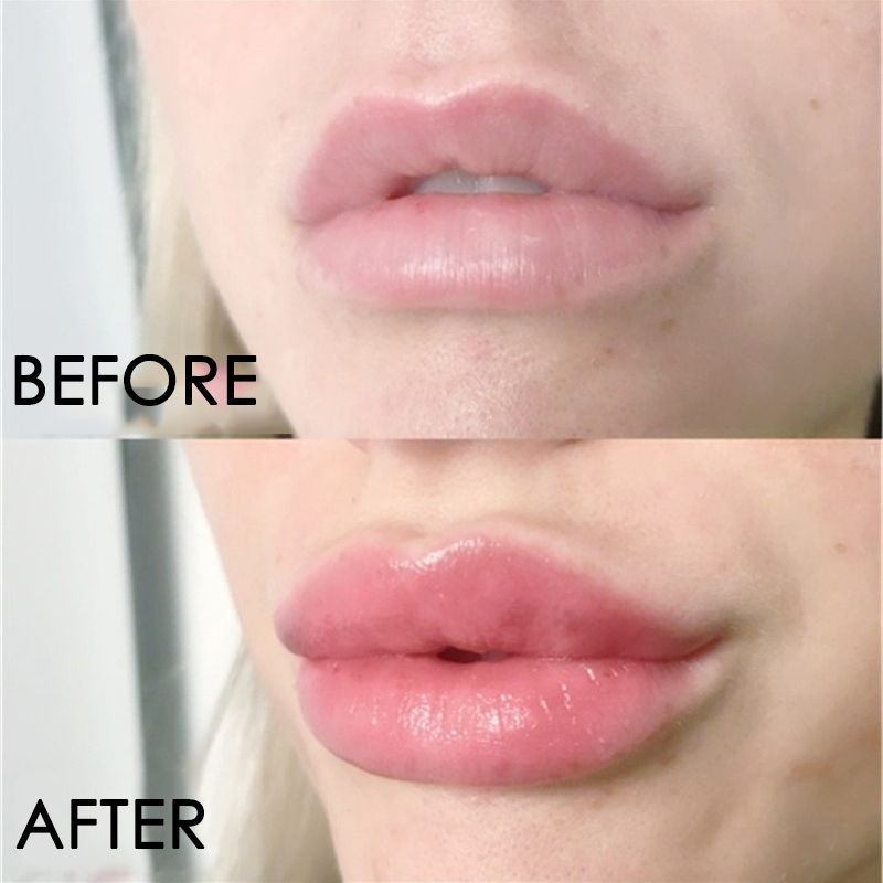 Lip Care Serum Instant Volumis - đánh giá và giá Lip Gloss Plumping